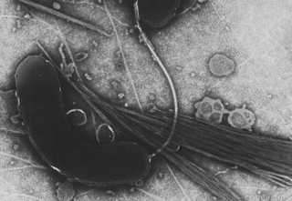 Illustration for article titled How cholera evolved to be one of the deadliest diseases in history